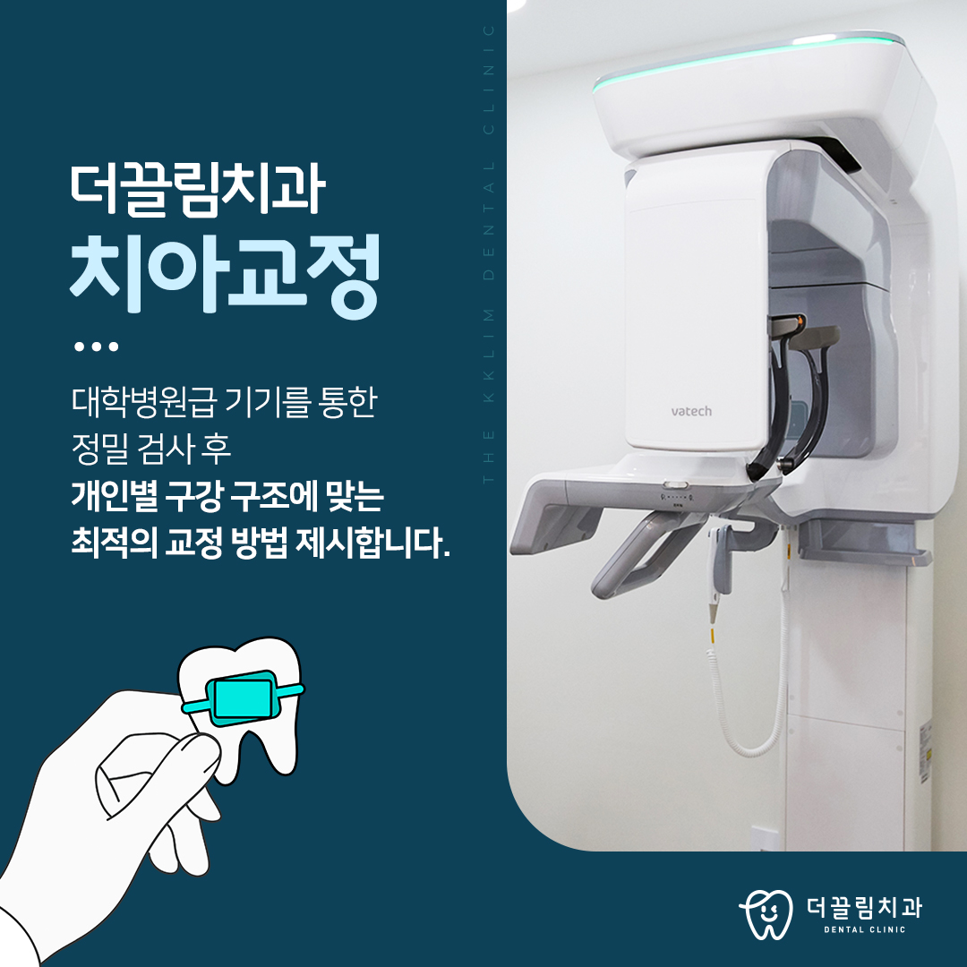 나에게 딱 맞는 교정 장치 선택법